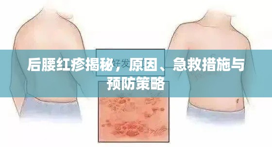 后腰红疹揭秘,原因、急救措施与预防策略