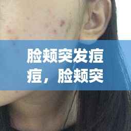 脸颊突发痘痘,脸颊突然起痘痘怎么回事