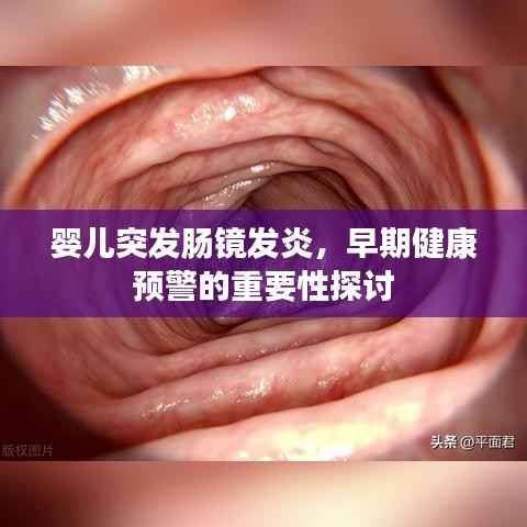 婴儿突发肠镜发炎,早期健康预警的重要性探讨